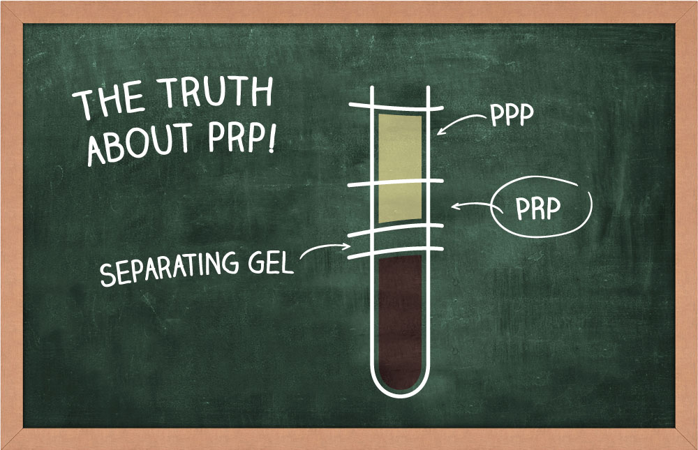 ezPRF Truth about PRP